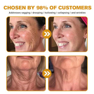 👨⚕️Botox Bee Venom Wrinkle Removal Cream