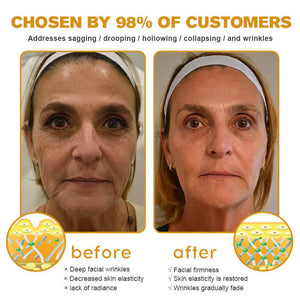 👨⚕️Botox Bee Venom Wrinkle Removal Cream