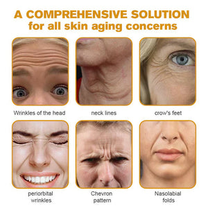 👨⚕️Botox Bee Venom Wrinkle Removal Cream