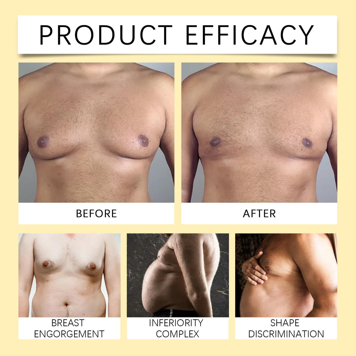 Chest Fat Bee Venom Gynecomastia Heating Oil